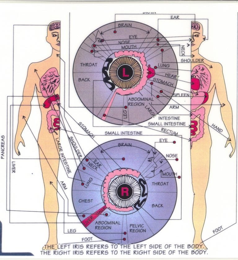How to read iridology chart?